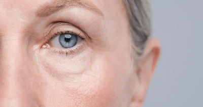 Jak opóźnić proces starzenia skóry do maksimum? Praktyczne porady i skuteczne metody